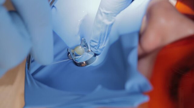 Dental procedure on caucasian female adult with protective gear, installing cofferdam rubber seal for dental filling.