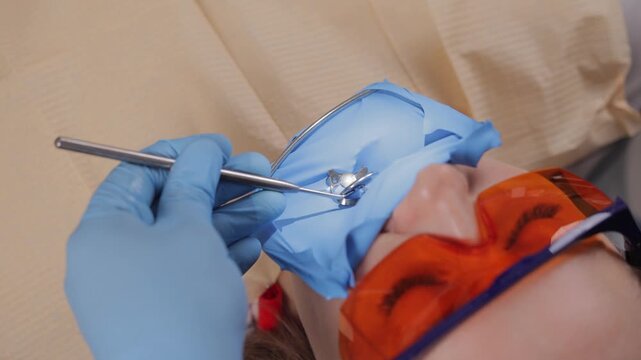 Dental procedure tooth filling with tools on molar under blue dental dam cofferdam.