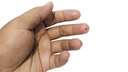 Small blood drop on index finger tip, symbolizing a prick, injury, or blood sugar test. White background.