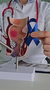 A doctor holds a blue ribbon with a model of the human colon anatomy. March is Colorectal Cancer Awareness Month, a month of colorectal cancer awareness, colon disease awareness, ulcerative colitis aw