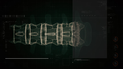 Biotech X-ray scan of cervical spine with digital HUD diagnostics, neural pathways, and medical...