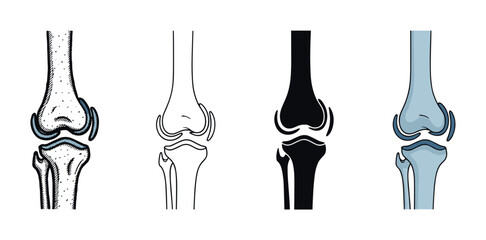 Four human knee joint anatomy illustrations in a set of different styles including hand-drawn sketch, simple line art, solid black silhouette, and a flat color vector design