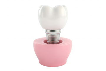 A modern dental implant model a white crown seated on a pink base. symbolizing advanced dental technology and care. ideal for educational materials or dental clinics