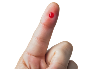 Isolated finger prick blood drop test, human hand measuring diabetic glucose sugar, medical health care liquid sample, closeup bleeding wound analysis