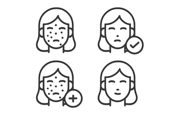 Before and after comparison of acne skin problems and clear healthy face treatment