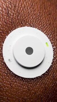 Extreme Close-Up of Glucose Sensor Patch on Skin