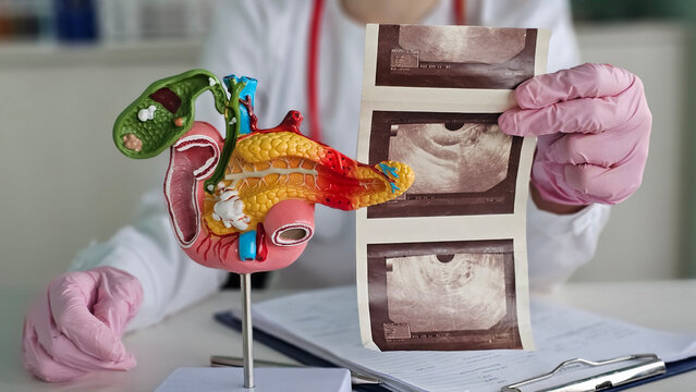 Detailed view of a medical model of the pancreas alongside ultrasound images in a clinic