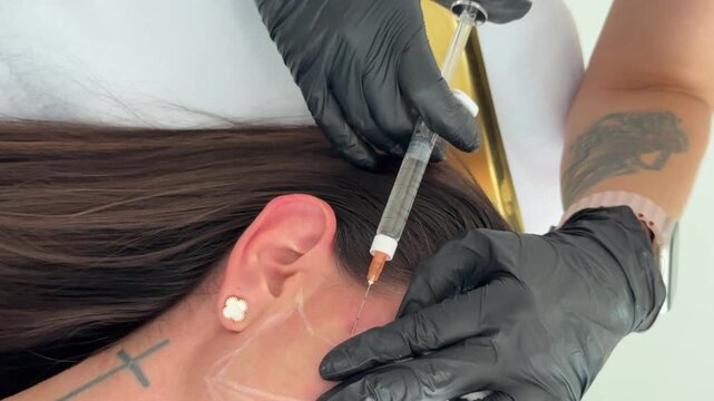 Aesthetic medicine: Close-up of collagen biorevitalization treatment with cannula injection into womans face by cosmetologist in black gloves