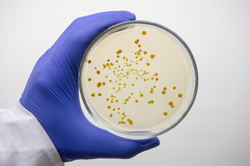 Pure colonies of actinobacteria on nutrient agar in a petri dish held by a scientist on a white...