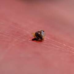 The bee left a sting with a vial of poison in the mans skin.