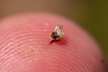 The bee left a sting with a vial of poison in the mans skin.