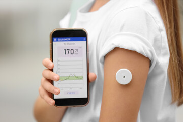 Teenage diabetic girl with continuous glucose monitor using mobile app for sugar level measuring in park, closeup