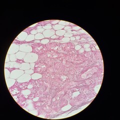 Elastic Cartilage Tissue Under Microscope – Human Histology Micrograph (High-Resolution Pink Stain)