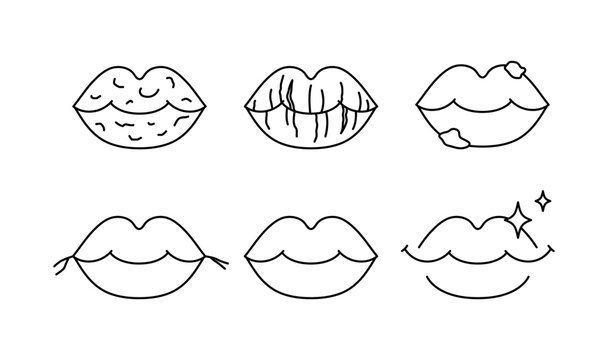 Lip disease icons set. Peeling lips, cracked lips, sores. Line vector, editable stroke