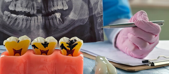 Dentist evaluating dental x-ray while discussing treatment options during patient consultation