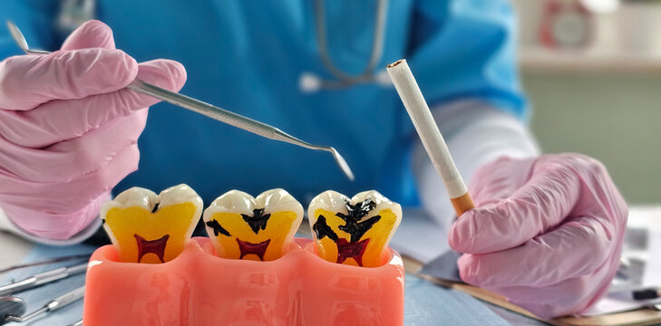 Dental education on the impact of smoking on oral health with models