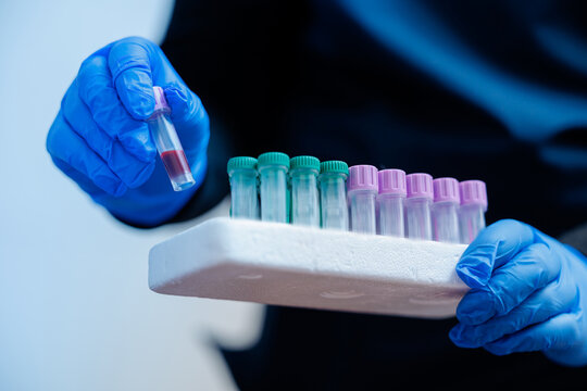 Veterinary clinic laboratory technician holding blood samples of dog in test tubes - Powered by Adobe
