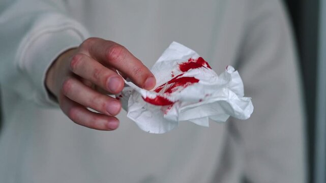 A man noticed traces of blood on the toilet paper after going to the toilet.
Blood on toilet paper.
Hemorrhoids and colon inflammation.
Infection, proctologist, toilet, pain, blood