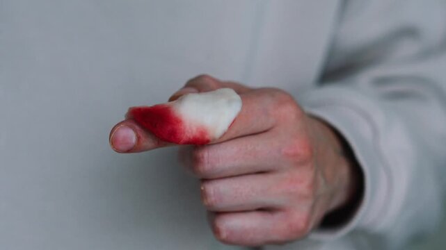 Disinfecting a wound from infection.
Severe bleeding and pain in a finger.
A young man's injured hand and blood on a cotton swab.
Disinfecting a hand from infection and germs.
Pain, wound, blood