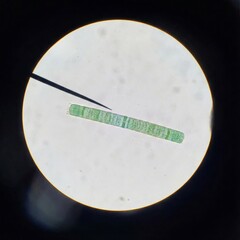 Microscopic image of green algae specimen, commonly used in biology studies