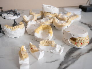 Dental prosthetic models with ceramic crowns for orthodontics, dental implants, prosthodontics,...