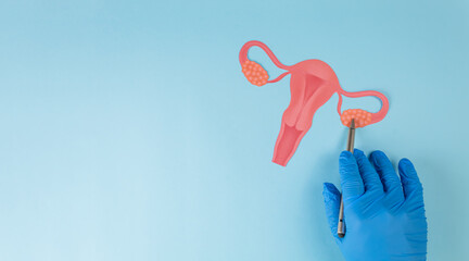 A gynecologist's hand points to an ovary in a cardboard cutout image against a light blue background. Concept of early detection of ovarian cancer and women's health awareness.
