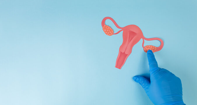 A gynecologist's hand points to an ovary in a cardboard cutout image against a light blue background. Concept of early detection of ovarian cancer and women's health awareness - Powered by Adobe