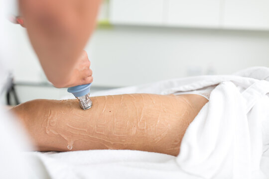 Professional aesthetic treatment on woman&rsquo;s legs in beauty clinic