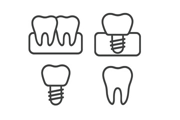 Healthy teeth, gum line, and various stages of tooth implant placement procedure