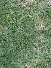 Green Grass Texture: Close-up detail of a green lawn with some lighter patches of dry grass.