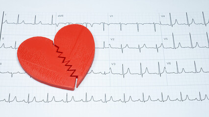 Concept of a broken heart due to a heart condition, red heart split in two, on an electrocardiogram