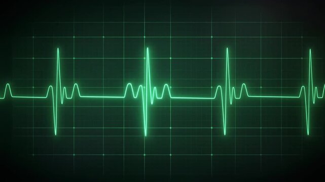 EKG Heartbeat Display on Monitor, Green Pulse Wave