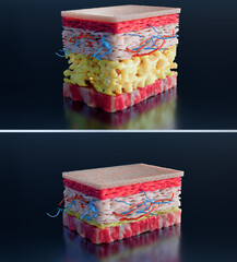 Weight loss Comparison. body transformation. Before and after a thick and thin waist, Fat belly before and slim fit, skin layers anatomy, fast weight loss process, Under Skin. fat burn, 3d render