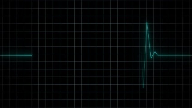 EKG Heart Monitoring Endless loop animation on black background. Full HD. 4K