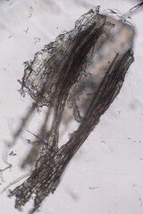 A high-magnification micrograph of a dense, dark, impacted structure, likely a blackhead (open comedo), extracted from facial skin, showing multiple hairs and cellular debris blocking