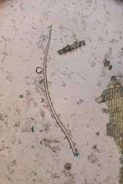 A microscopic field of a stool specimen showing a long, slender, curved parasitic nematode structure, likely the larva or a of the pinworm (Enterobius vermicularis)
