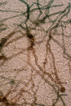 A high-magnification micrograph showing chains of dark, barrel-shaped fungal arthroconidia or chlamydospores arising from septate, pigmented hyphae, indicative of certain molds