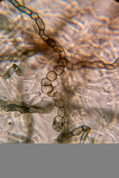A high-magnification micrograph showing chains of dark, barrel-shaped fungal arthroconidia or chlamydospores arising from septate, pigmented hyphae, indicative of certain molds