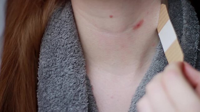 A young woman peels off a bandage on her scar on her neck after having a mole removed