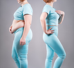 Before and after weight loss transformation, woman&rsquo;s fat body showing slimming results, liposuction, plastic surgery and tummy tuck concept