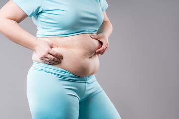 Woman pinching excess belly fat, weight loss and liposuction concept