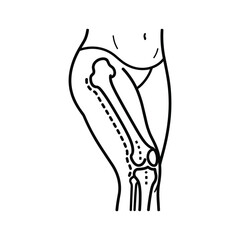 Outline drawing of human leg bones and joints including femur, patella, tibia, and fibula for medical use