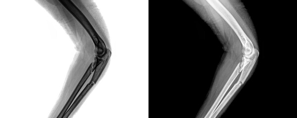 Elbow Lateral View X-Ray Radiograph Showing Clear Bone Contours and Joint Alignment for Assessment of Fractures, Trauma, and Structural Abnormalities Isolated on Transparent