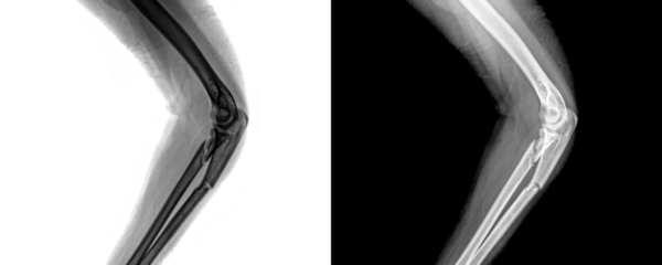 Elbow Lateral View X-Ray Radiograph Showing Clear Bone Contours and Joint Alignment for Assessment of Fractures, Trauma, and Structural Abnormalities Isolated on Transparent