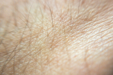 Close-up image of human skin revealing fine hairs and texture in natural tones, showcasing details of skin structure. Ideal for medical, beauty, or dermatological contexts.