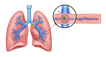 Human Lungs Anatomy with Alveoli respiratory system diagram illustration medical science
