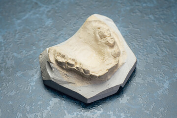 Impression of Dental Arch Model for Orthodontic Applications on Textured Surface