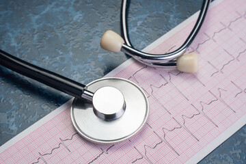 Stethoscope on electrocardiogram chart showing heart rhythm analysis