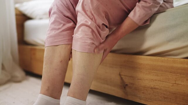 Aged woman massaging legs, suffering cramps and varicose vein disease