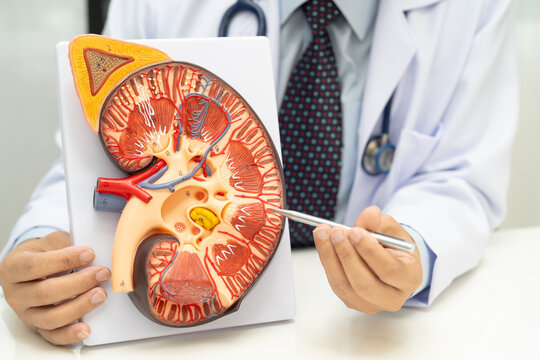 Kidney disease, Chronic kidney disease ckd, Doctor hold human model to treat and study in hospital.